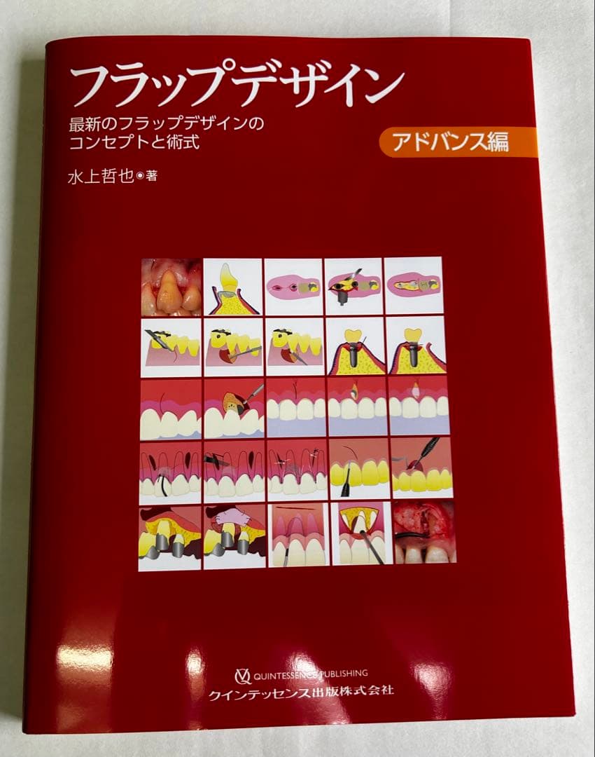 フラップデザイン　アドバンス編 最新のフラップデザインのコンセプトと術式