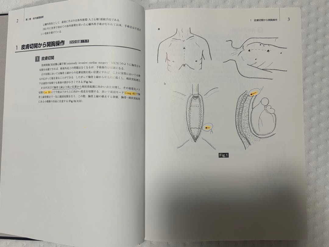 心臓血管外科手術書 磯村