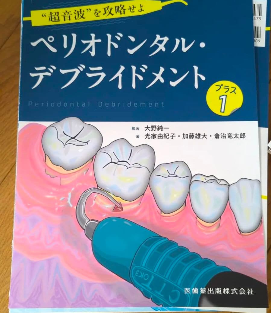 はじめての全部床義歯 根管洗浄 根管充塡 ペリオドンタルデブライドメント