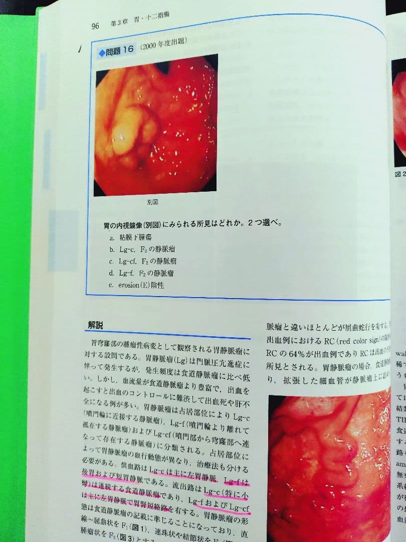 日本消化器内視鏡学会 専門医 学術試験問題〈解答と解説〉第5版 第3版 第2版