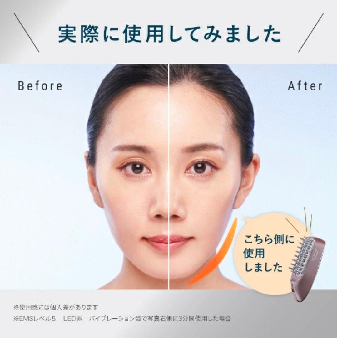 アンファスカルプDボーテスカルプ電気ブラシ新品