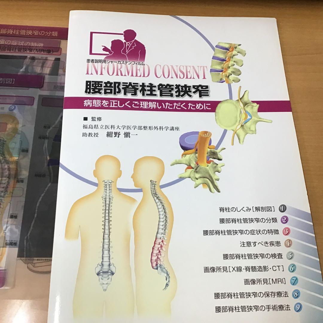 シャウカステン（シャーカステン）＋脊柱管説明フィルムセット