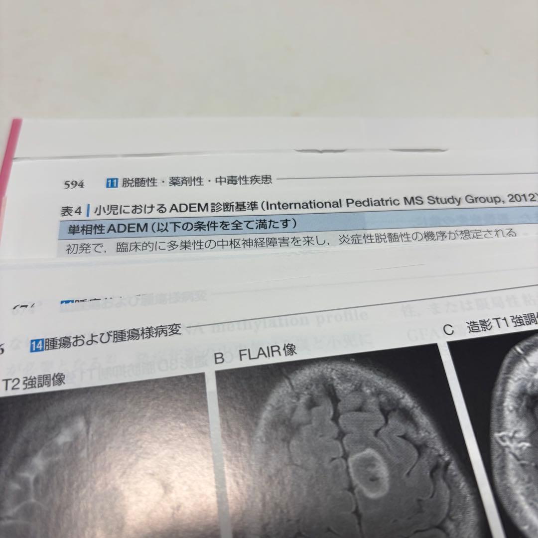 【裁断済み】小児神経の画像診断 改訂第2版