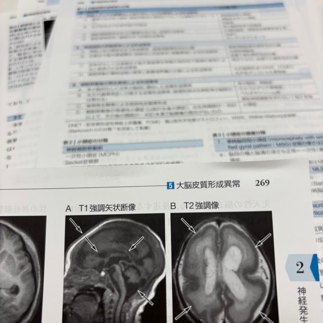【裁断済み】小児神経の画像診断 改訂第2版