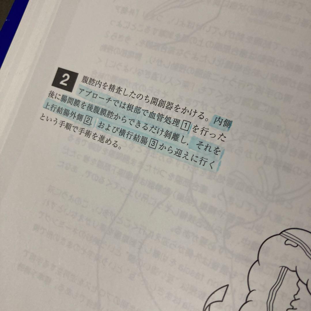 イラストレイテッド外科手技 膜の解剖からみた術式のポイント