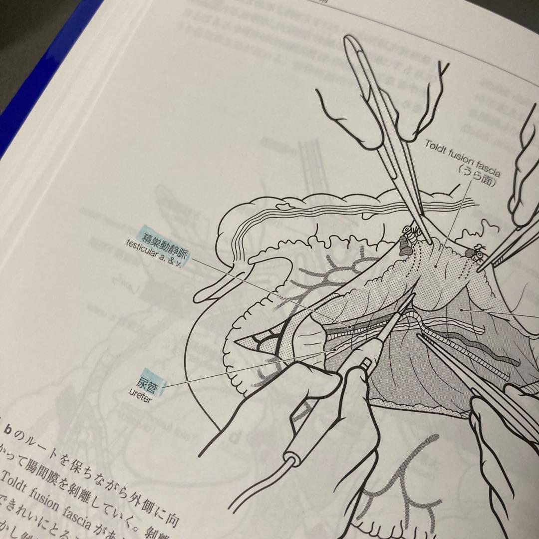 イラストレイテッド外科手技 膜の解剖からみた術式のポイント