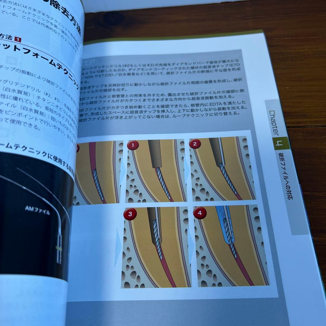 ビジュアル歯内療法学　生物学的コンセプトとテクニックのすべて