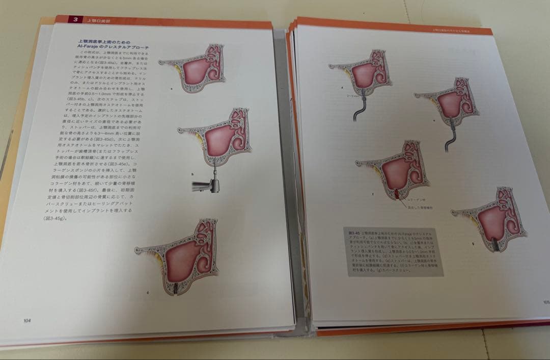 【裁断済】アナトミー 2 インプラント臨床のための解剖