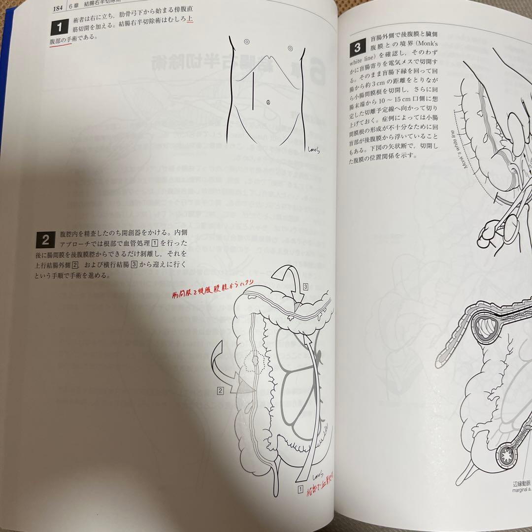 イラストレイテッド外科手術 : 膜の解剖からみた術式のポイント
