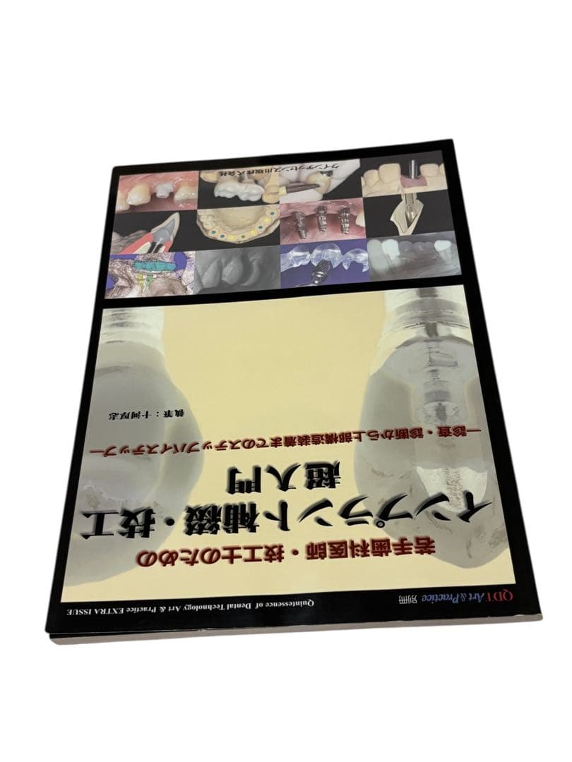 別冊 若手歯科医師・技工士のためのインプラント補綴・技工 超入門