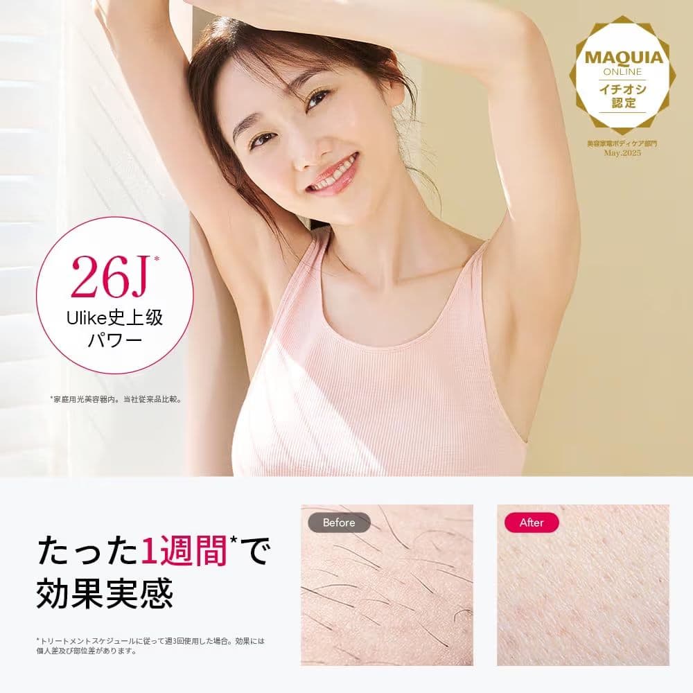 Ulike 脱毛器 Air10 光美容器 髭/脇/VIO/脚/腕 全身対応可能