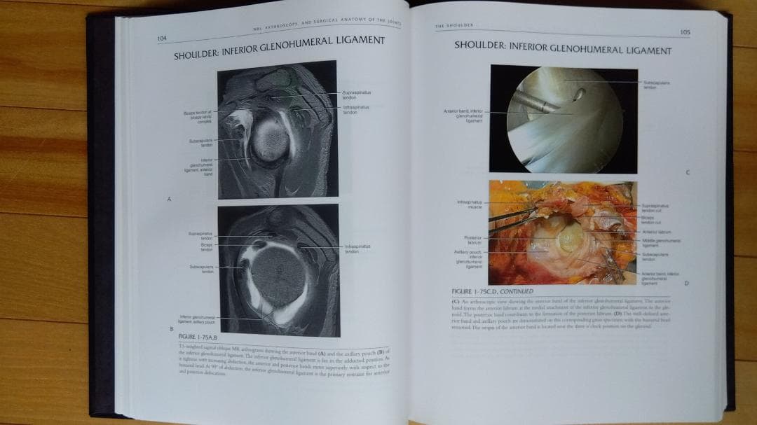 健康・医学 MRI ARTHROSCOPY and SURGICAL ANATOMY