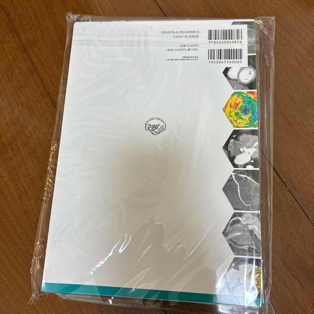 心臓疾患のCTとMRI 裁断済み