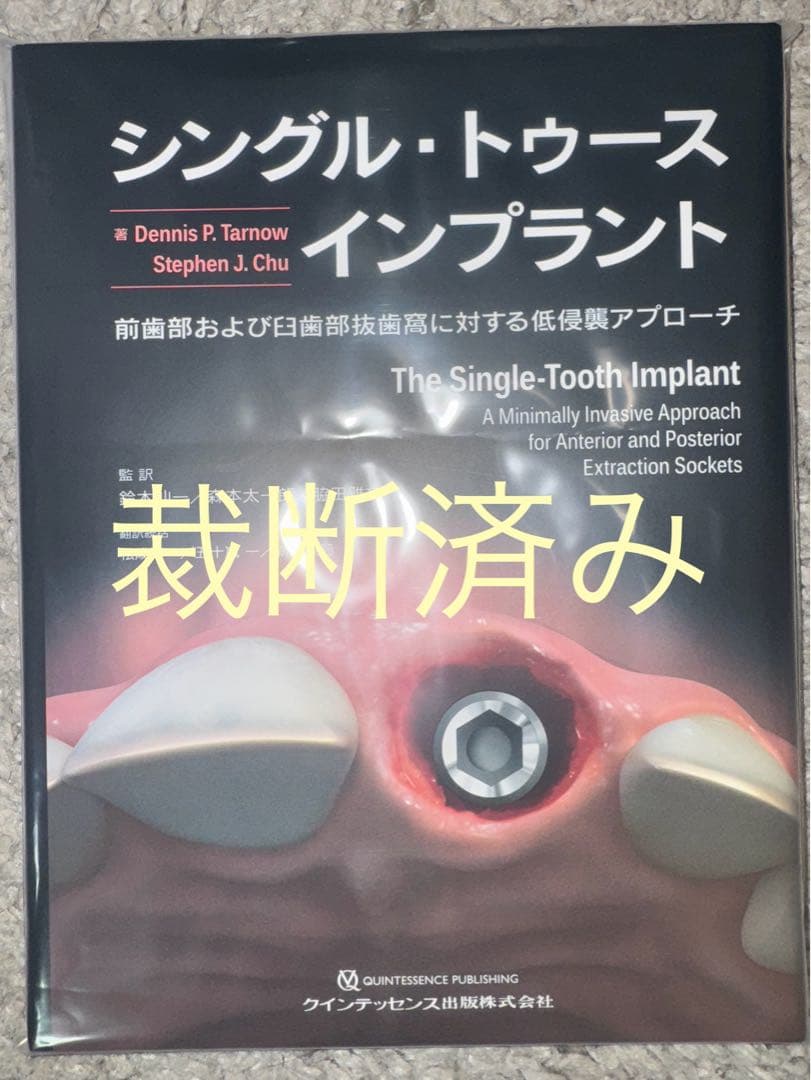 【裁断済み】シングル・トゥース インプラント