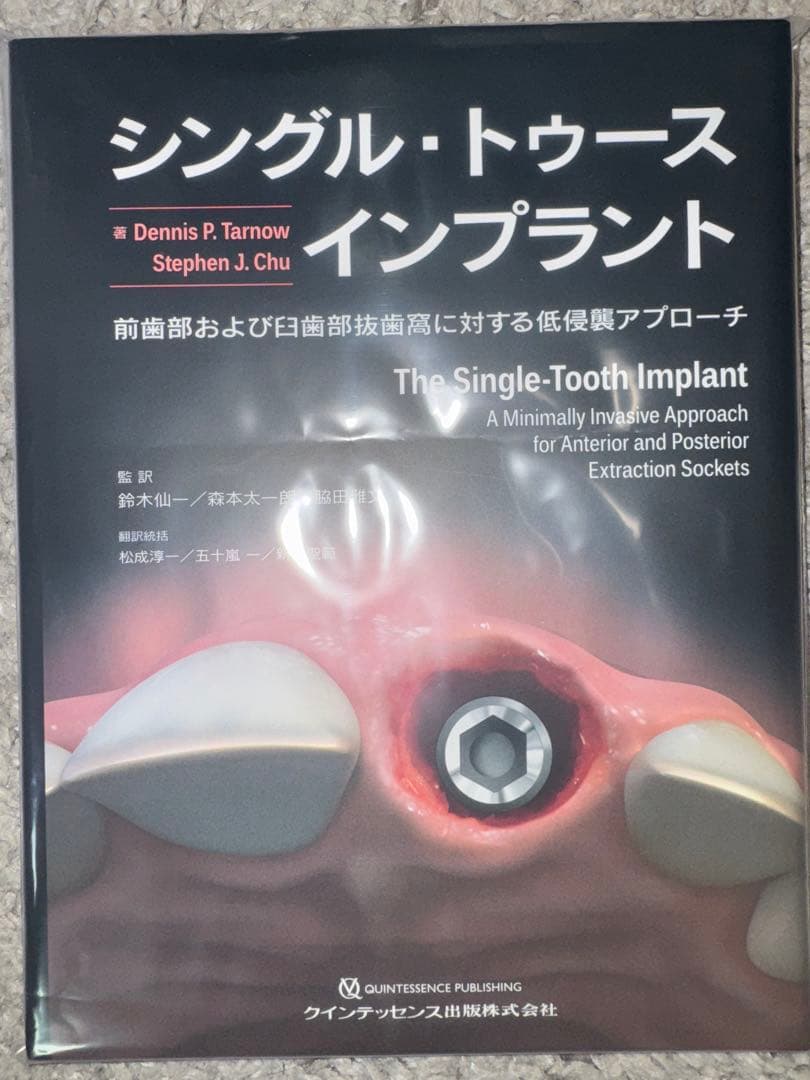 【裁断済み】シングル・トゥース インプラント