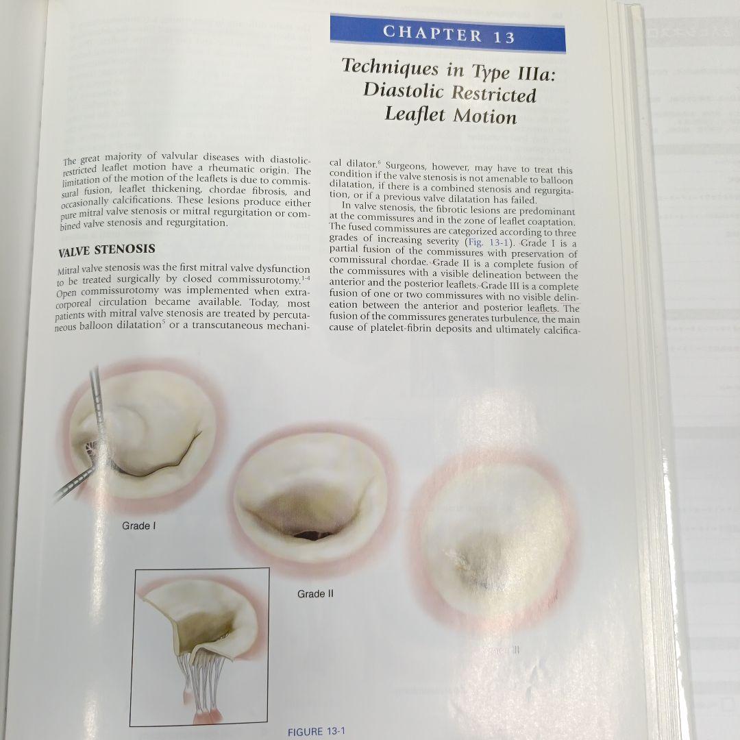 カーペンティアReconstructive valve surgery