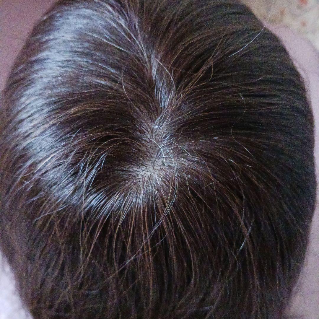 月末迄の限定値下げ★医療用人毛ミックス★フルウィッグ