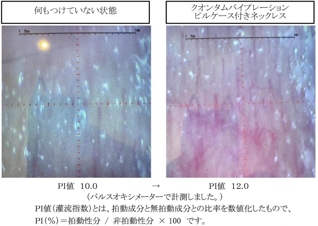 テラヘルツ鉱石を入れたアンクレット 長さ25cm ２本入り 赤色