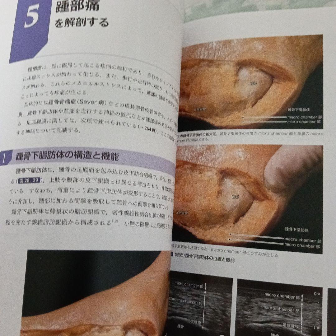 運動療法　その前に！運動器の臨床解剖アトラス
