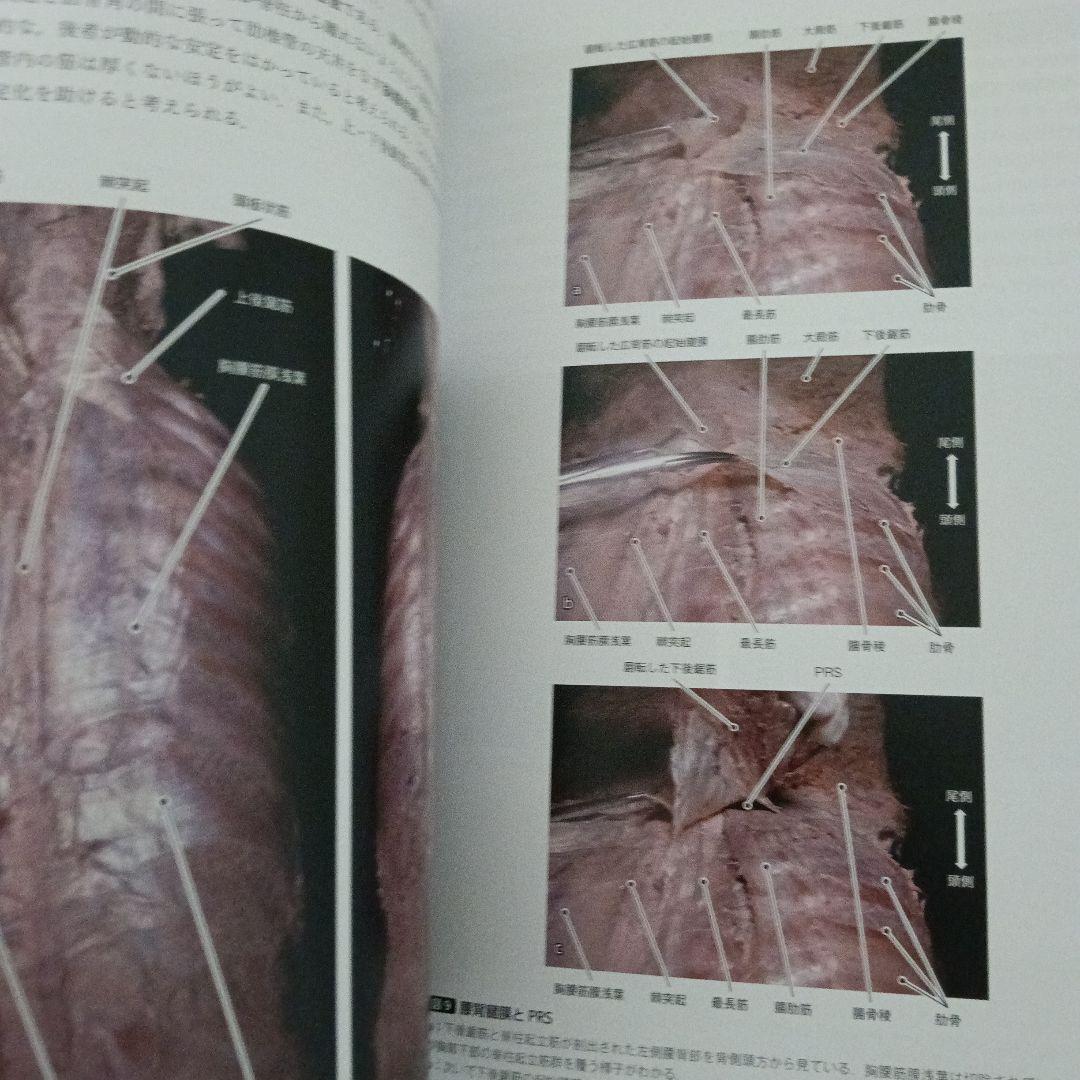 運動療法　その前に！運動器の臨床解剖アトラス