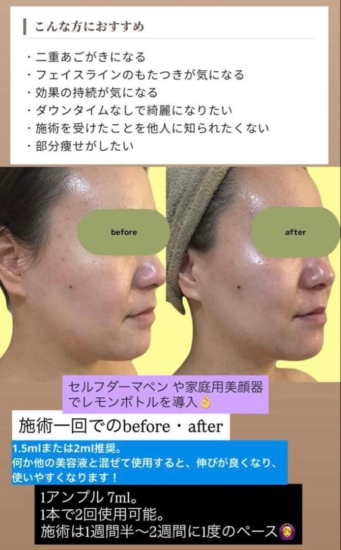 sky　レモンボトル×2本