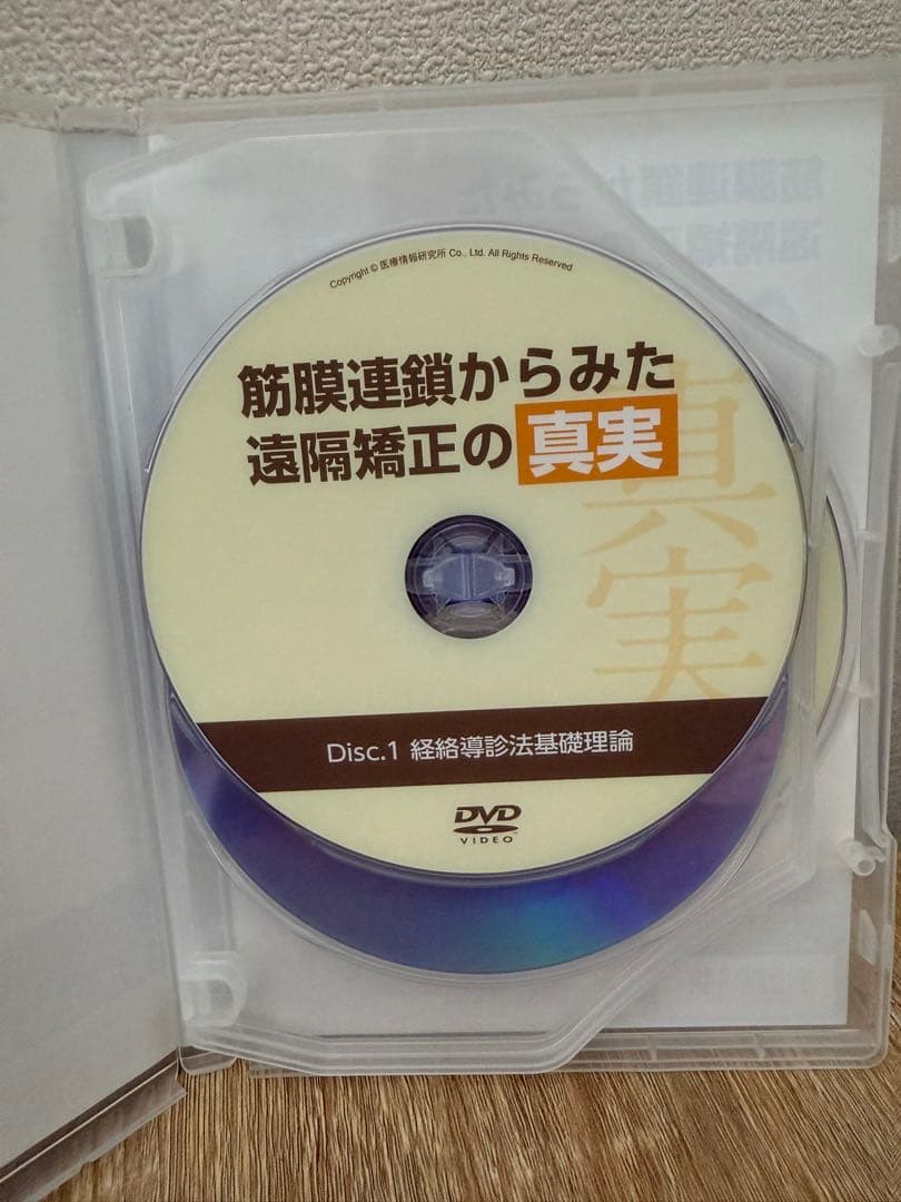 筋膜連鎖からみた遠隔矯正の真実