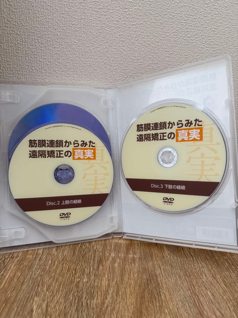 筋膜連鎖からみた遠隔矯正の真実