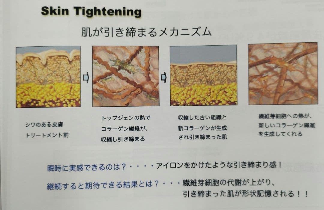 業務用 ラジオ波 エステマシン トライポーラ RF　値下げ交渉有り