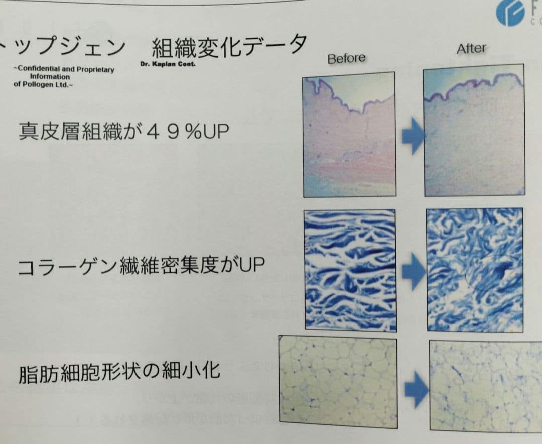 業務用 ラジオ波 エステマシン トライポーラ RF　値下げ交渉有り
