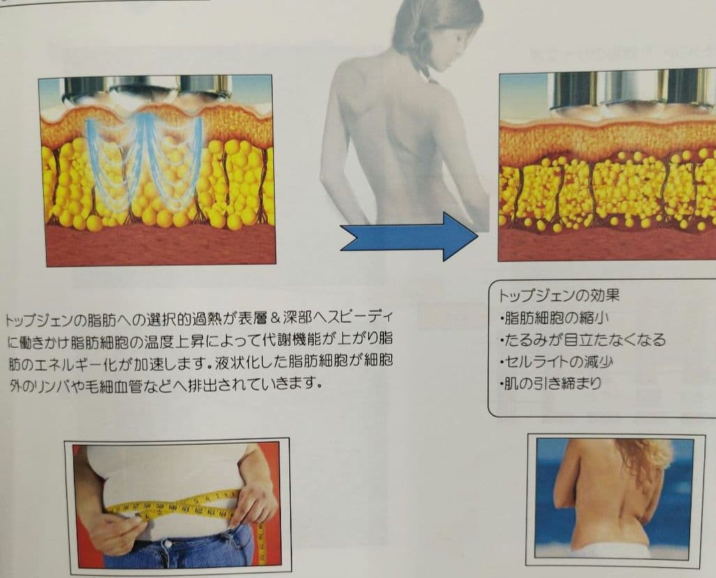 業務用 ラジオ波 エステマシン トライポーラ RF　値下げ交渉有り