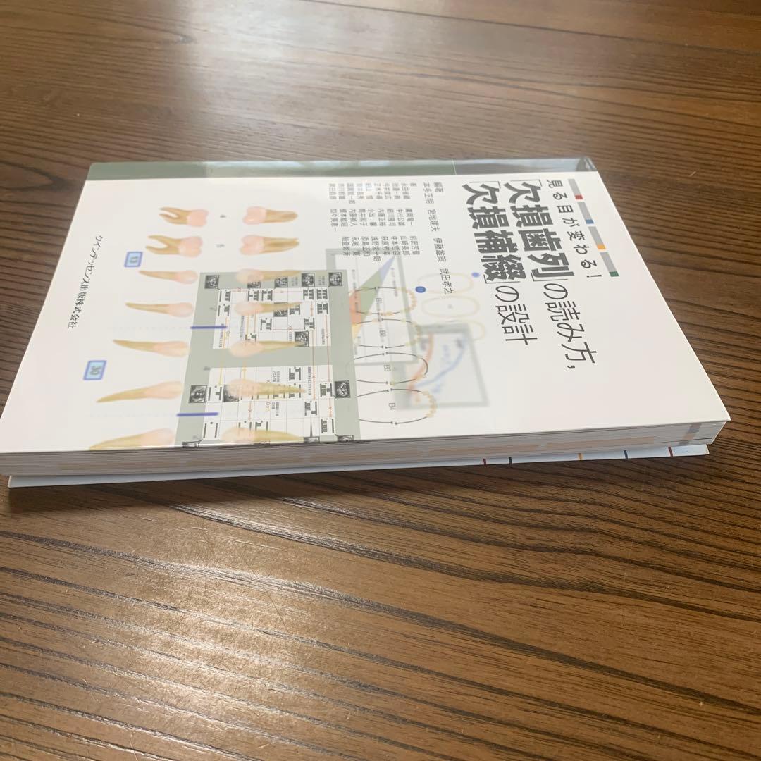 見る目が変わる!「欠損歯列」の読み方,「欠損補綴」の設計