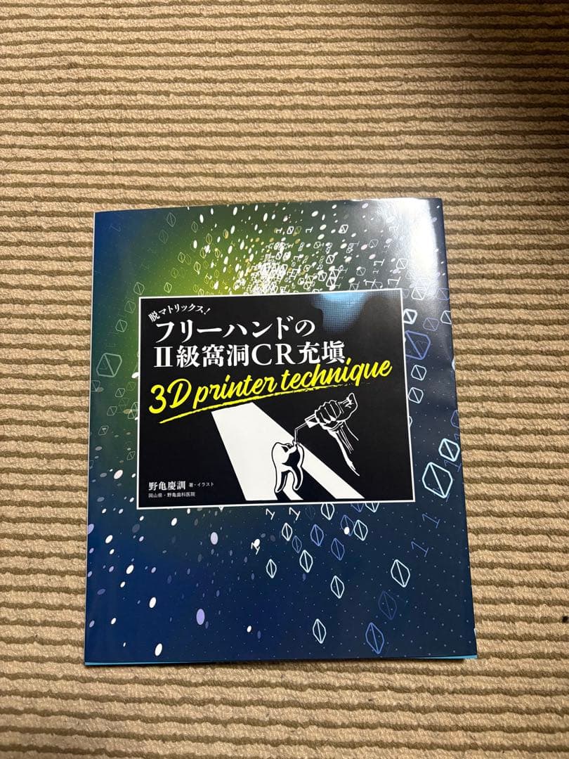 フリーハンドの II級窩洞CR充填 3D printer technique