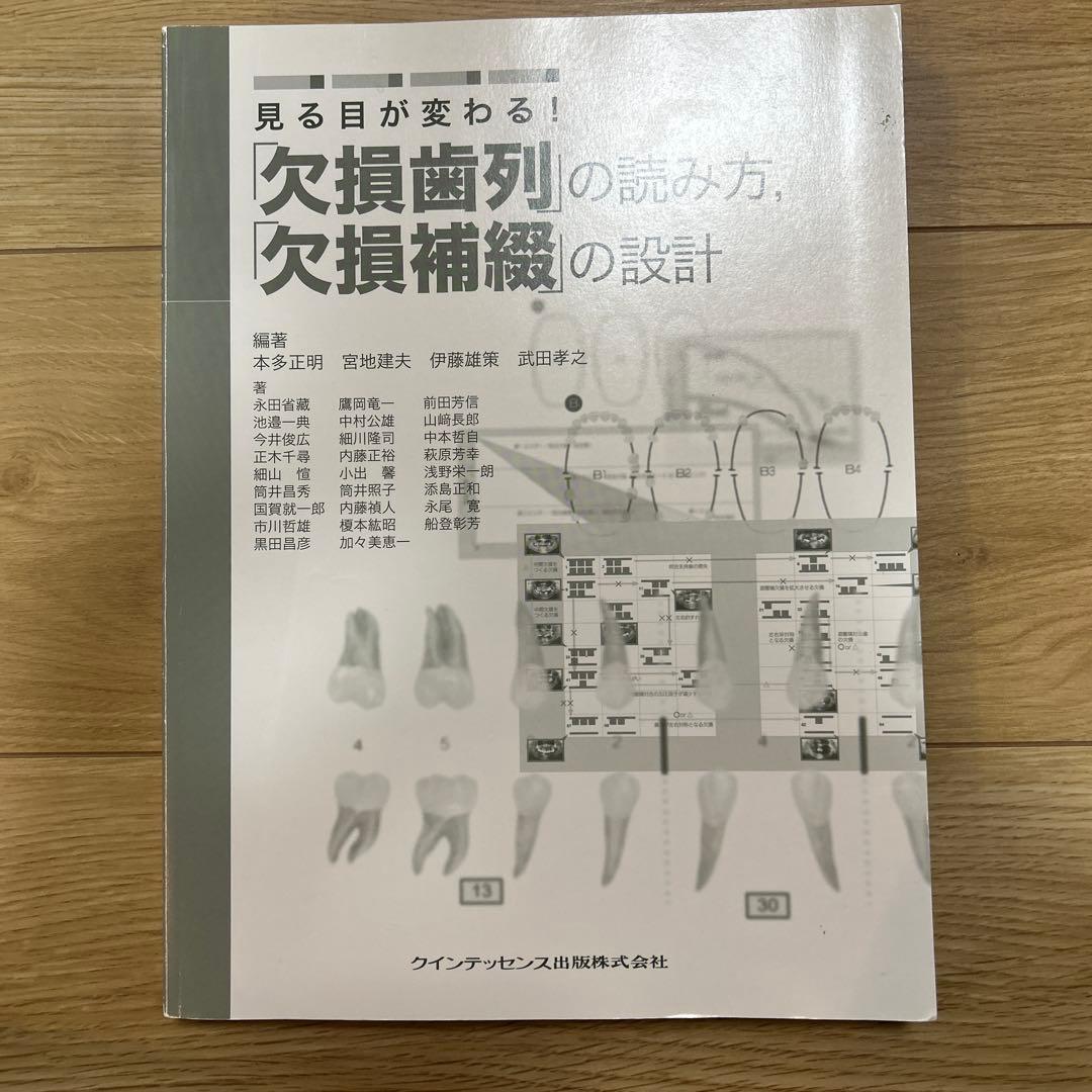 見る目が変わる！　「欠損歯列」の読み方，「欠損補綴」の設計