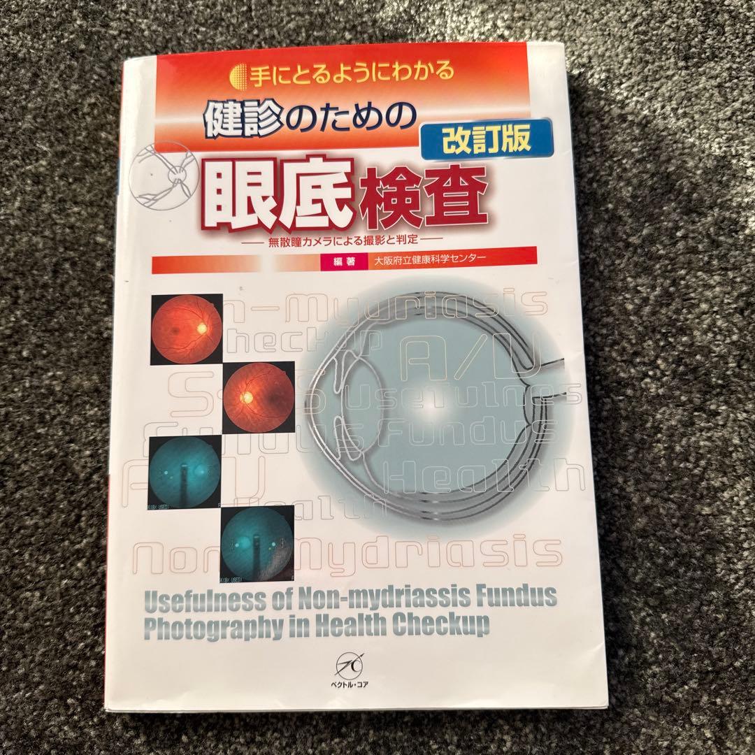 手にとるようにわかる健診のための眼底検査 : 無散瞳カメラによる撮影と判定