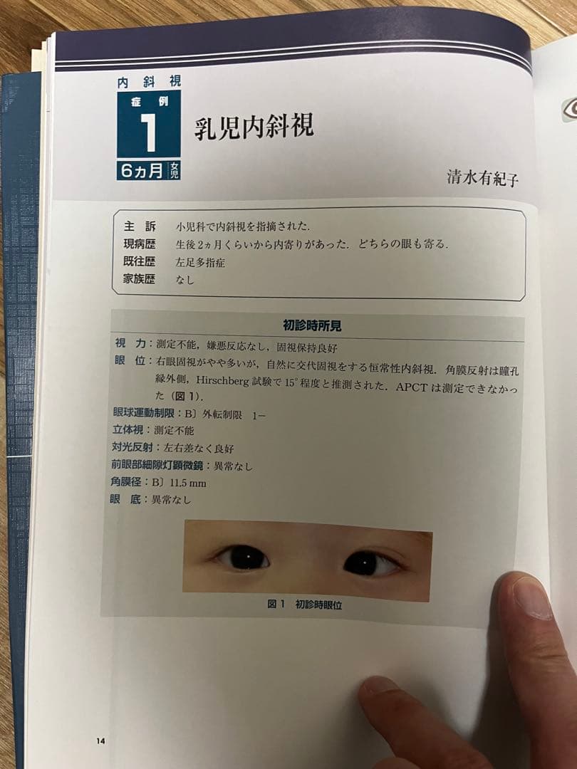 斜視治療のストラテジー