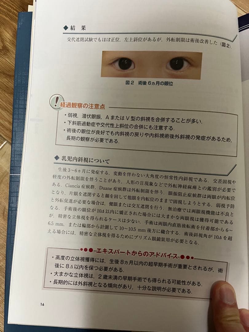 斜視治療のストラテジー