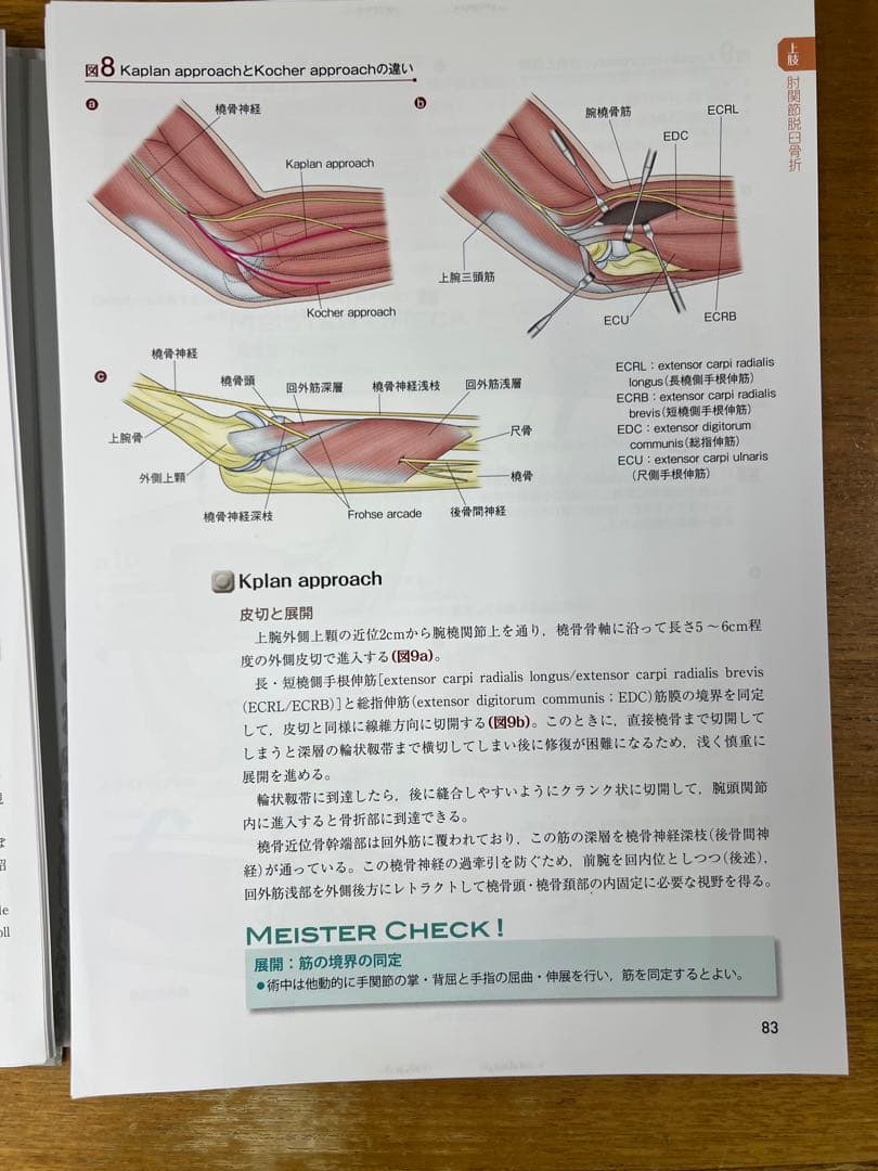 骨折プレート治療マイスター