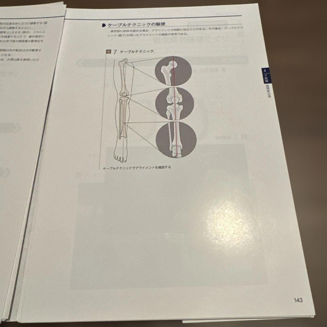 一時的創外固定マニュアル