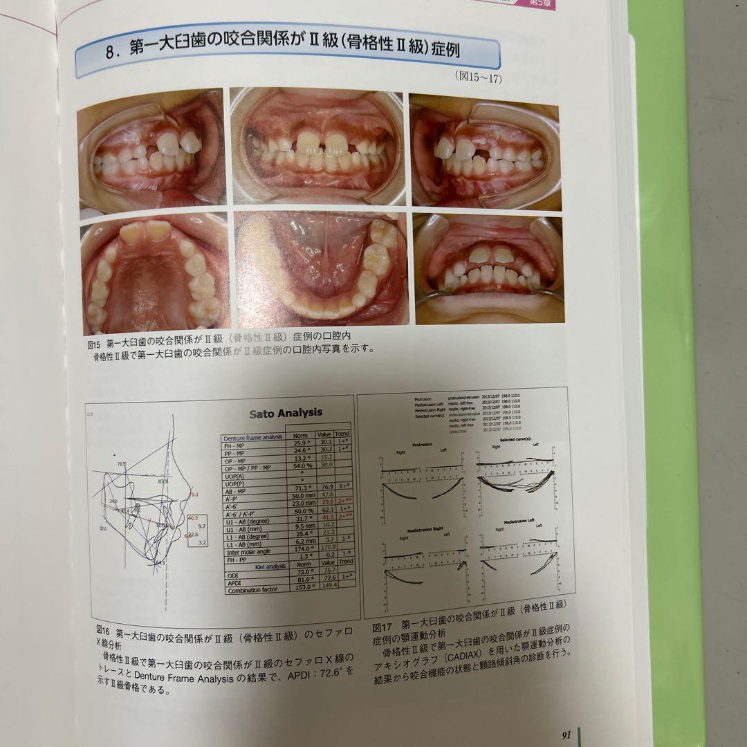 成長・発達期における不正咬合の早期治療