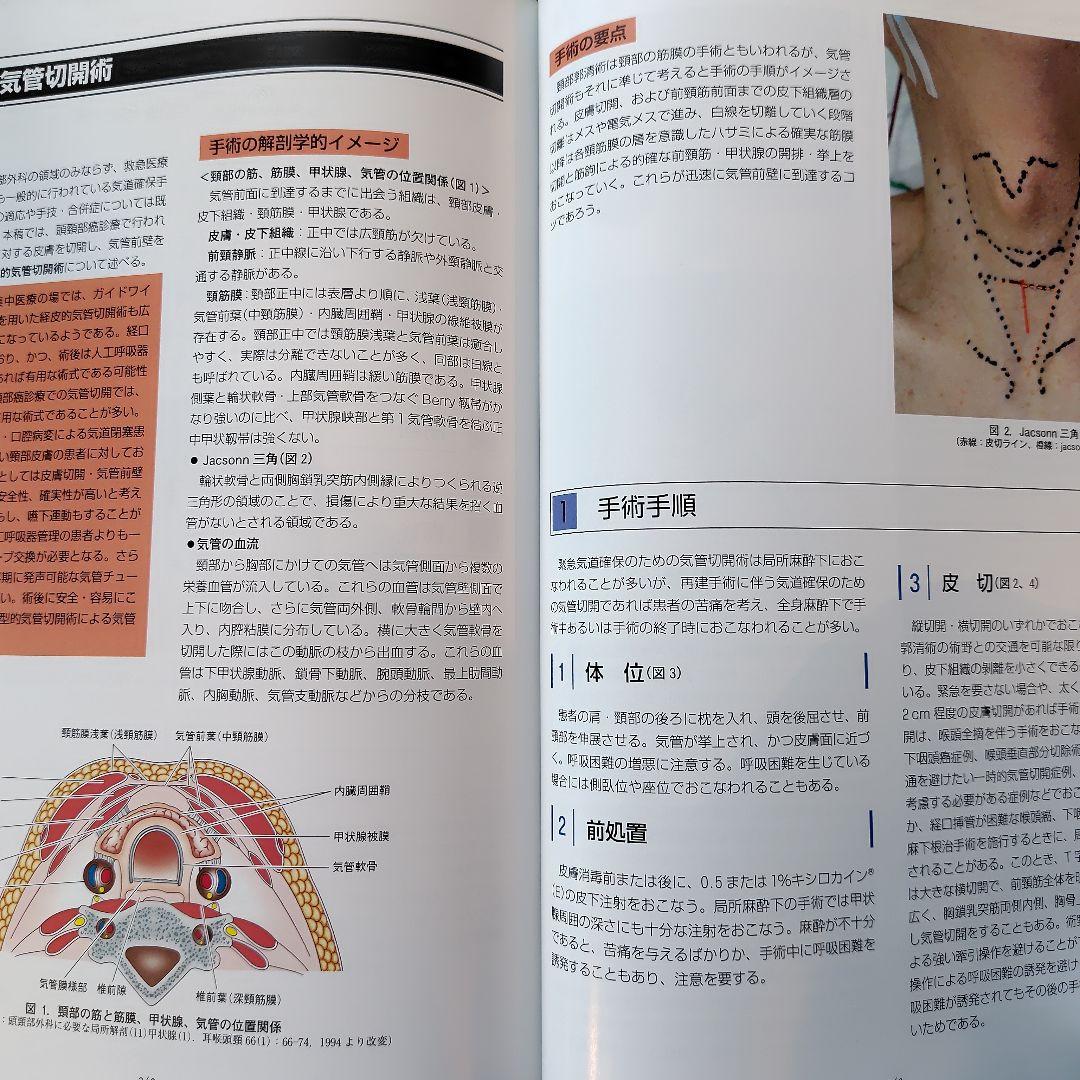 頭頸部手術カラーアトラス