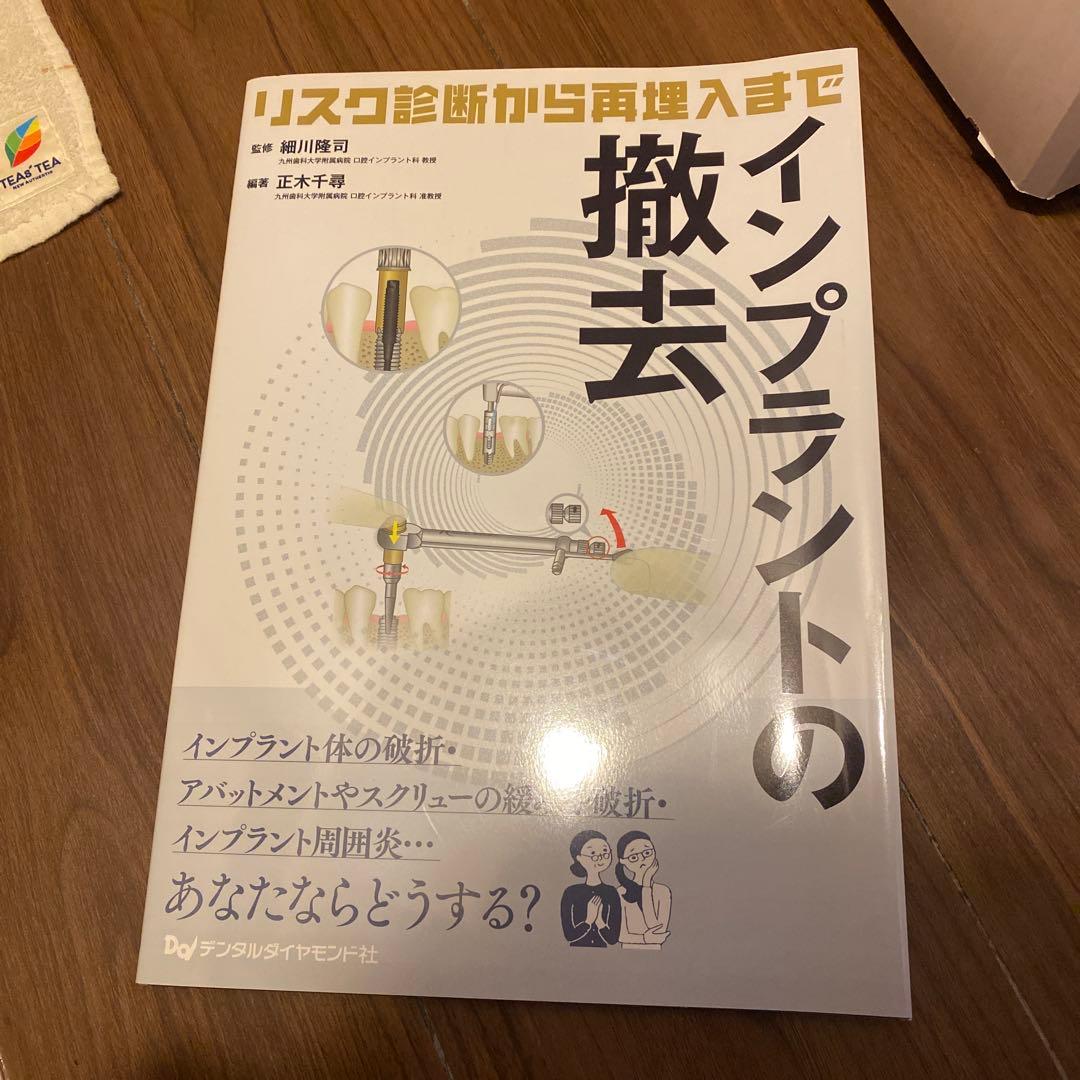 インプラントの撤去