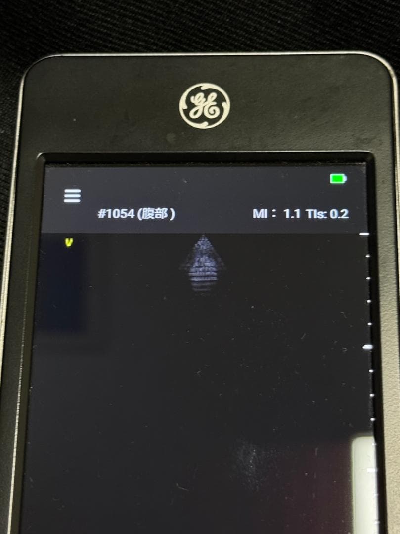 GE Vscan Extend 医療用モニタリング機器