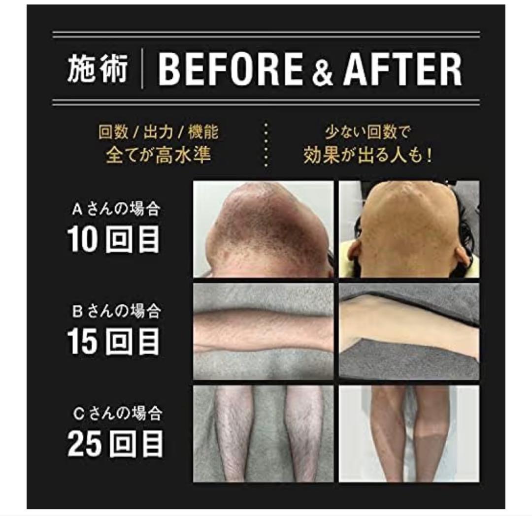 未開封  CLEAR MAX 脱毛器