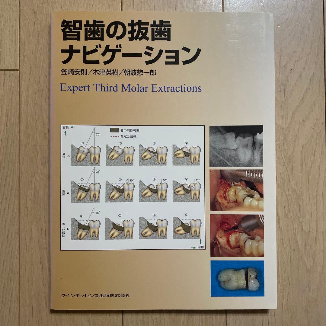 popo様　智歯の抜歯ナビゲーション