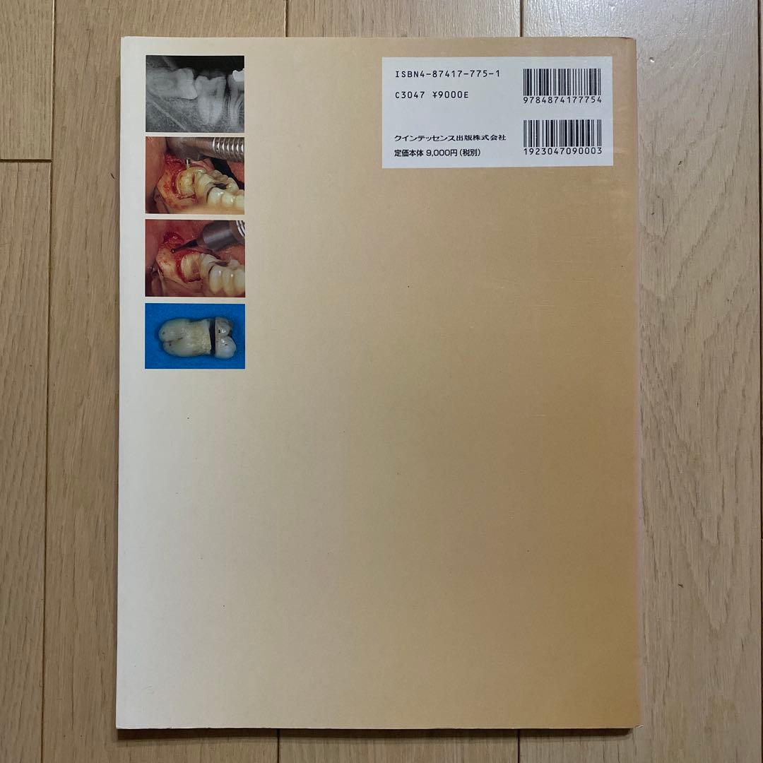 popo様　智歯の抜歯ナビゲーション