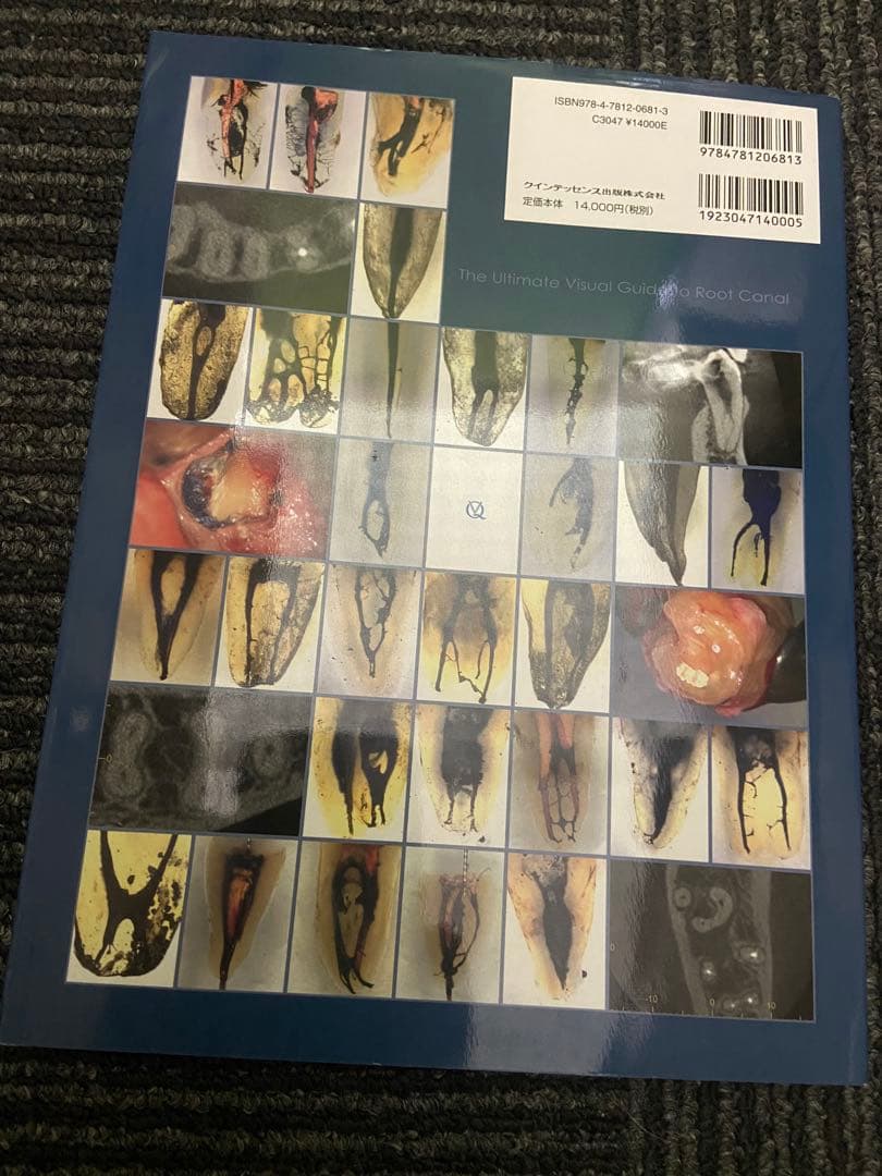 写真とエビデンスで歯種別に学ぶ! 歯内療法に生かす根管解剖