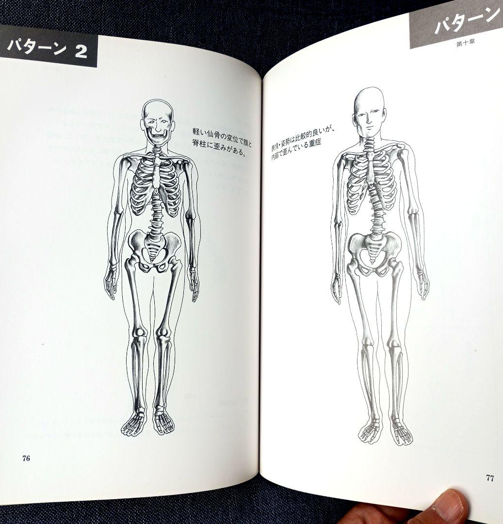 中級MRT仙骨無痛療法 初版