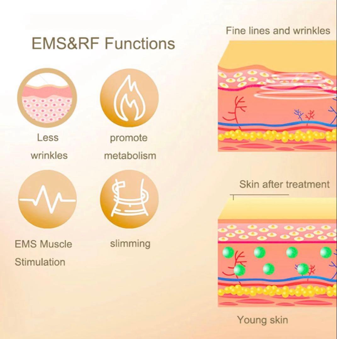 4in1業務用/家庭用キャビテーション40Khz/痩身/肌引き締め/脂肪吸引