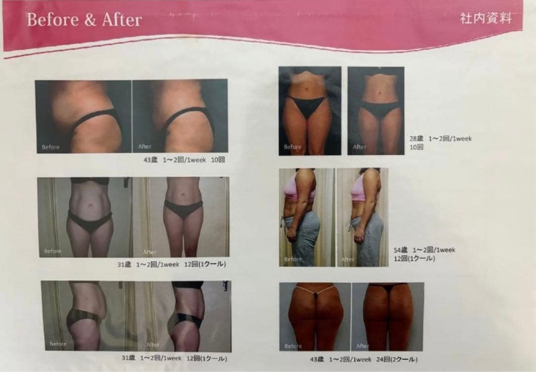 大手エステサロン導入品　業務用　キャビコンパクト