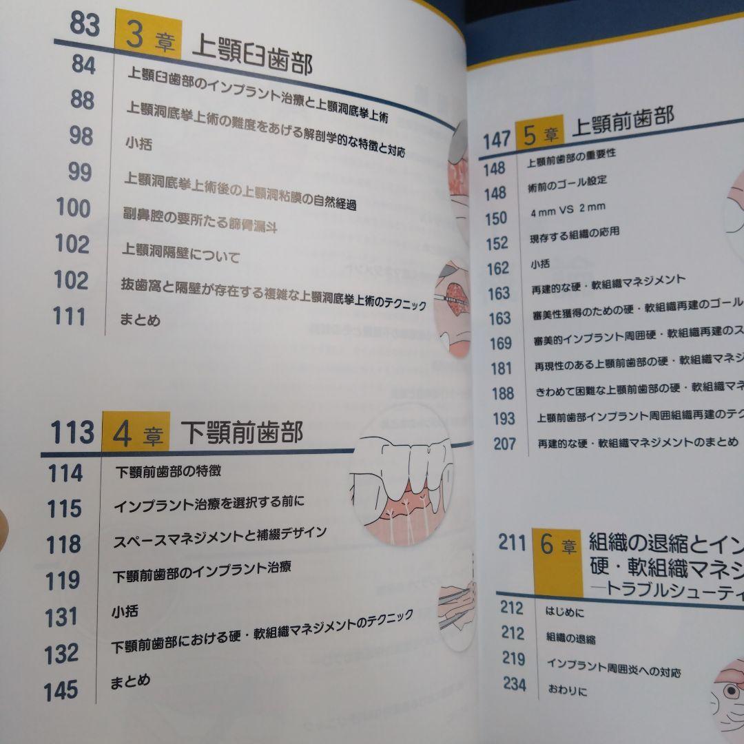 硬・軟組織マネジメント大全 インプラント　歯科 クインテッセンス出版